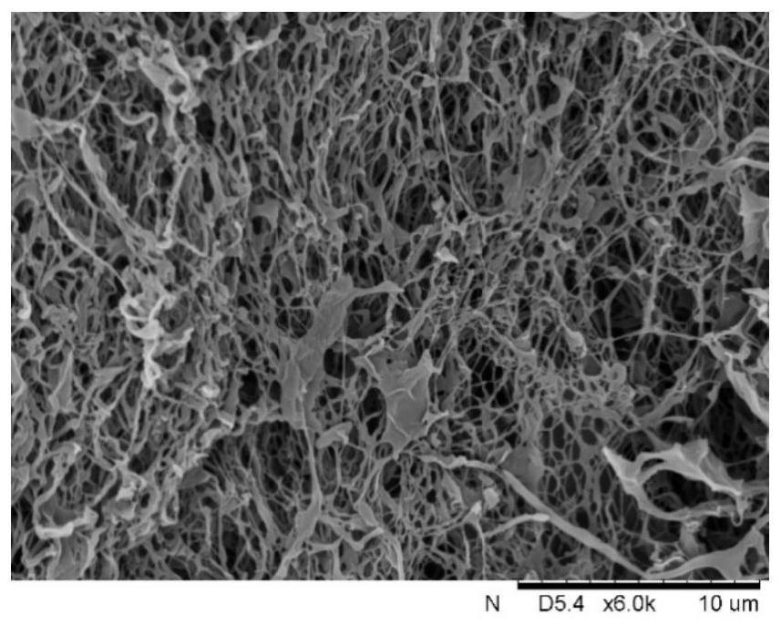 A double-layer periosteum for diabetic bone repair and its preparation method