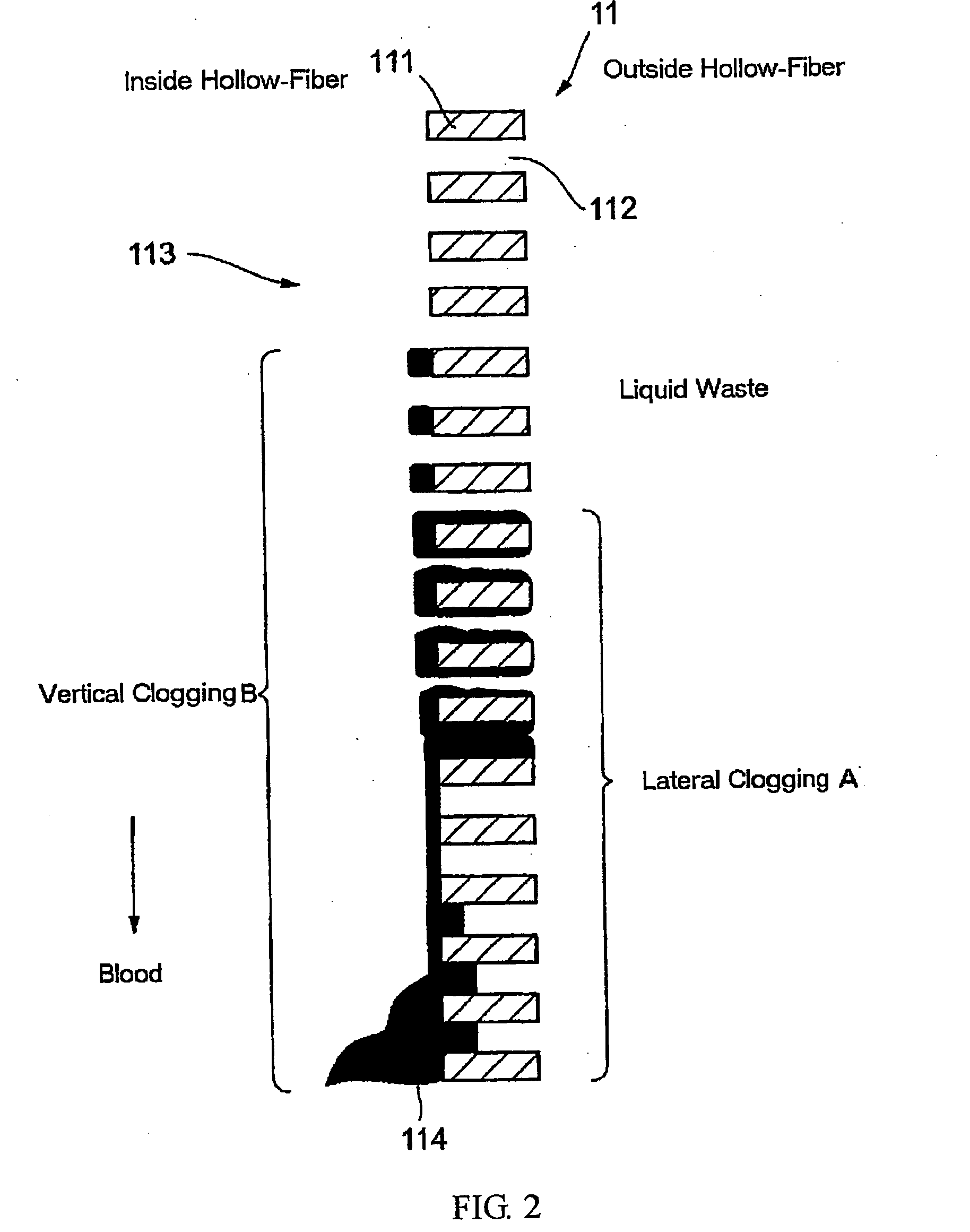 Method for calculating filter clogging factor and bed-side system