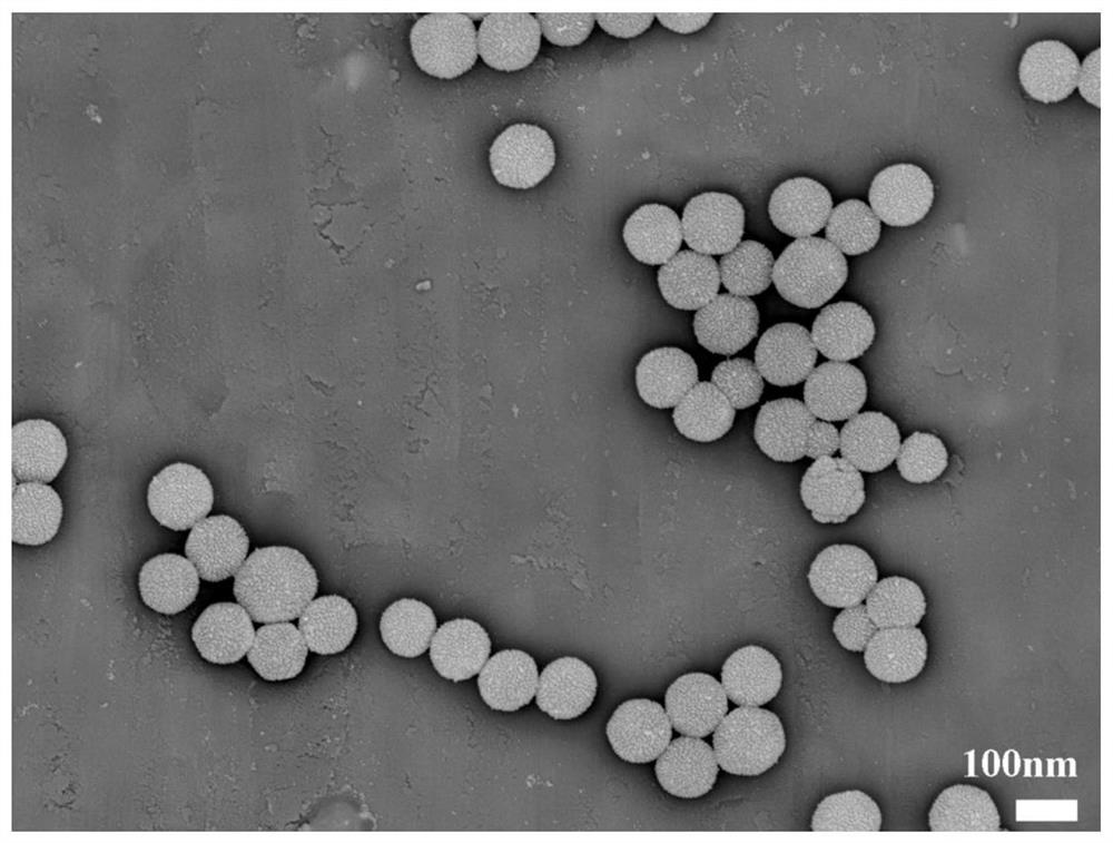 A zif-8 nanosphere loaded with au NPs and Fe simultaneously  <sub>3</sub> O  <sub>4</sub>  Methods for NPs