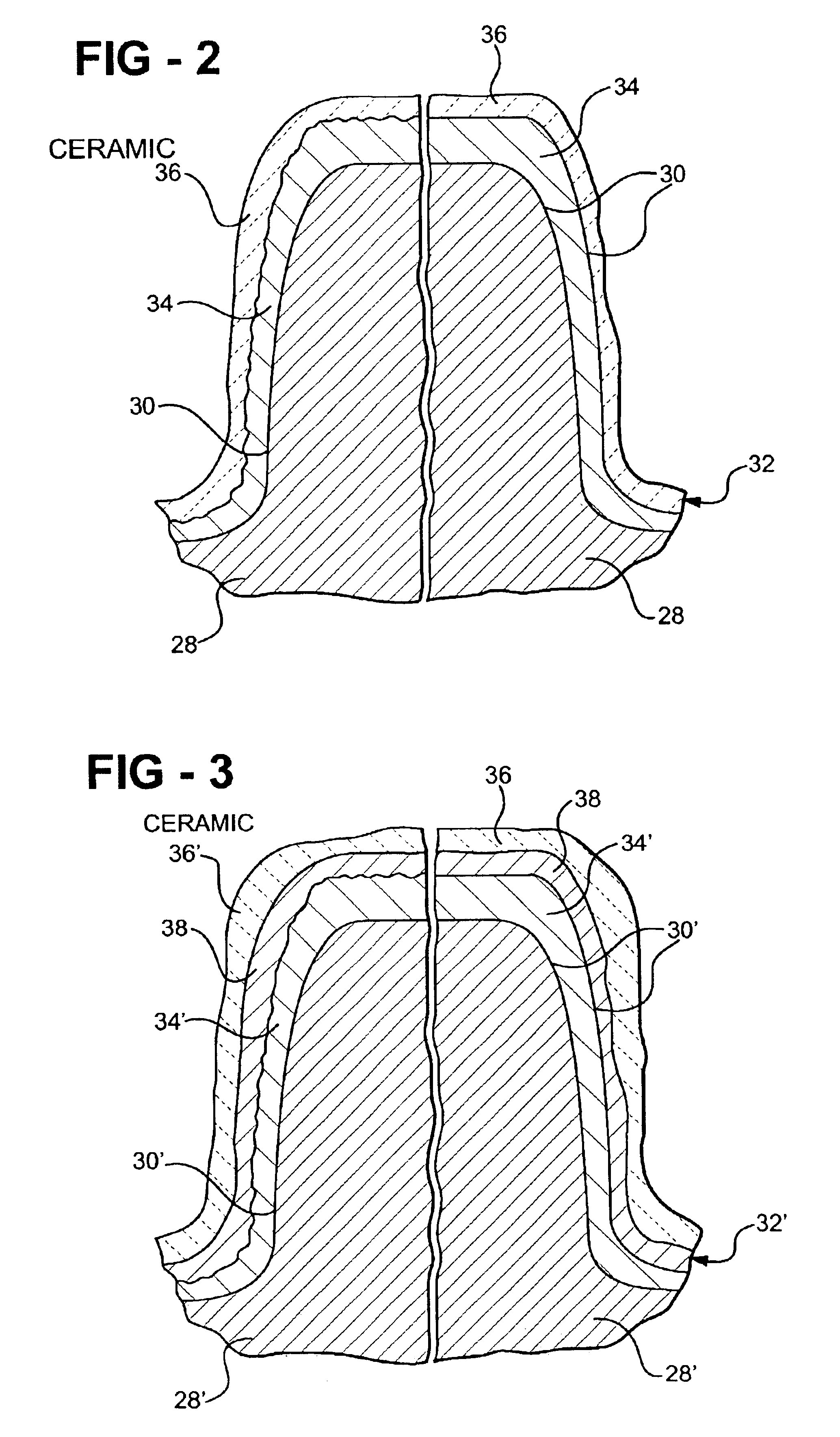 Planetary gearset with multi-layer coated sun gear