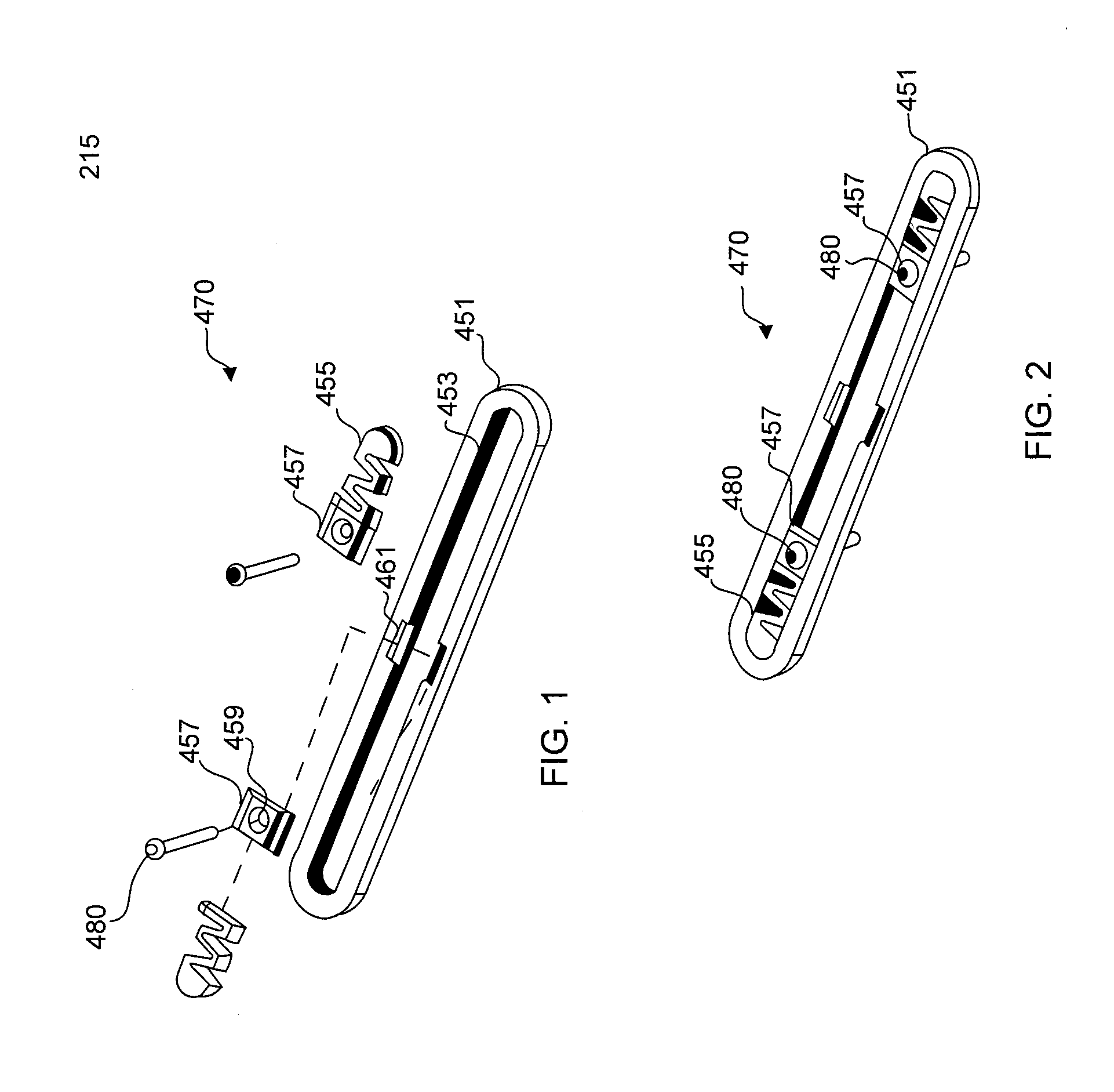 Bone screw system and method for the fixation of bone fractures