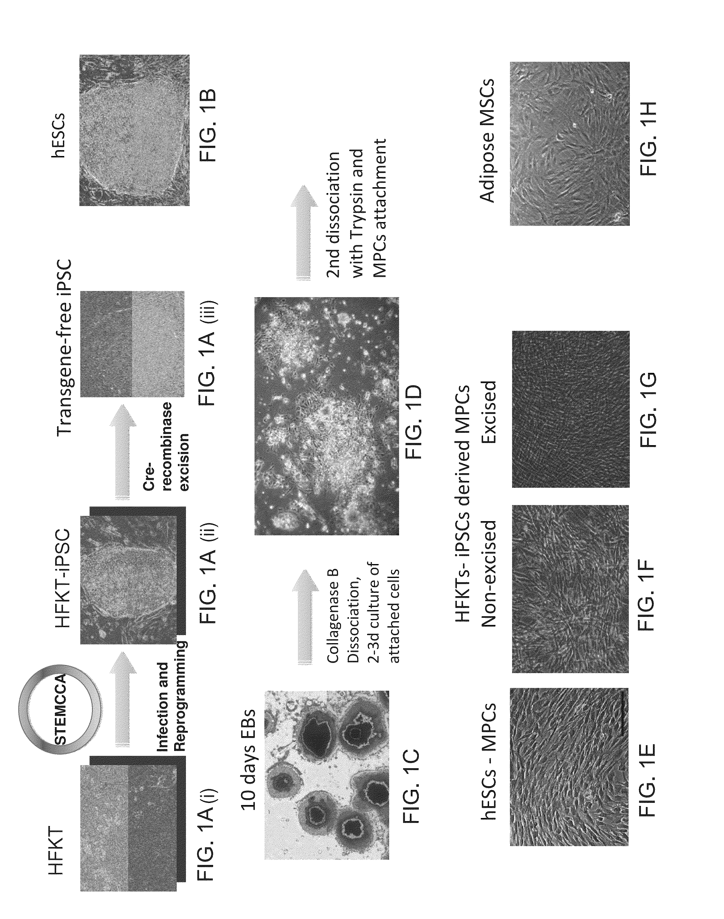 Isolated mesenchymal progenitor cells and extracellular matrix produced thereby