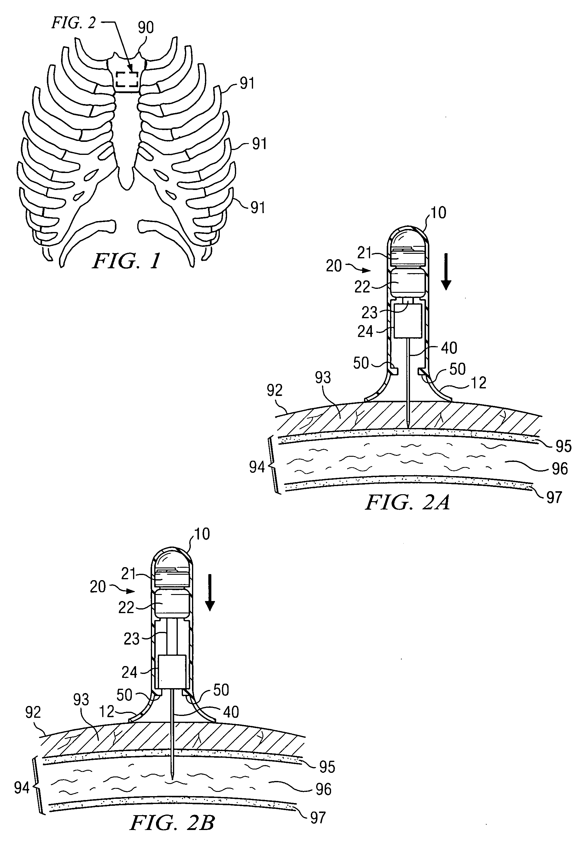 Apparatus and method for accessing the bone marrow