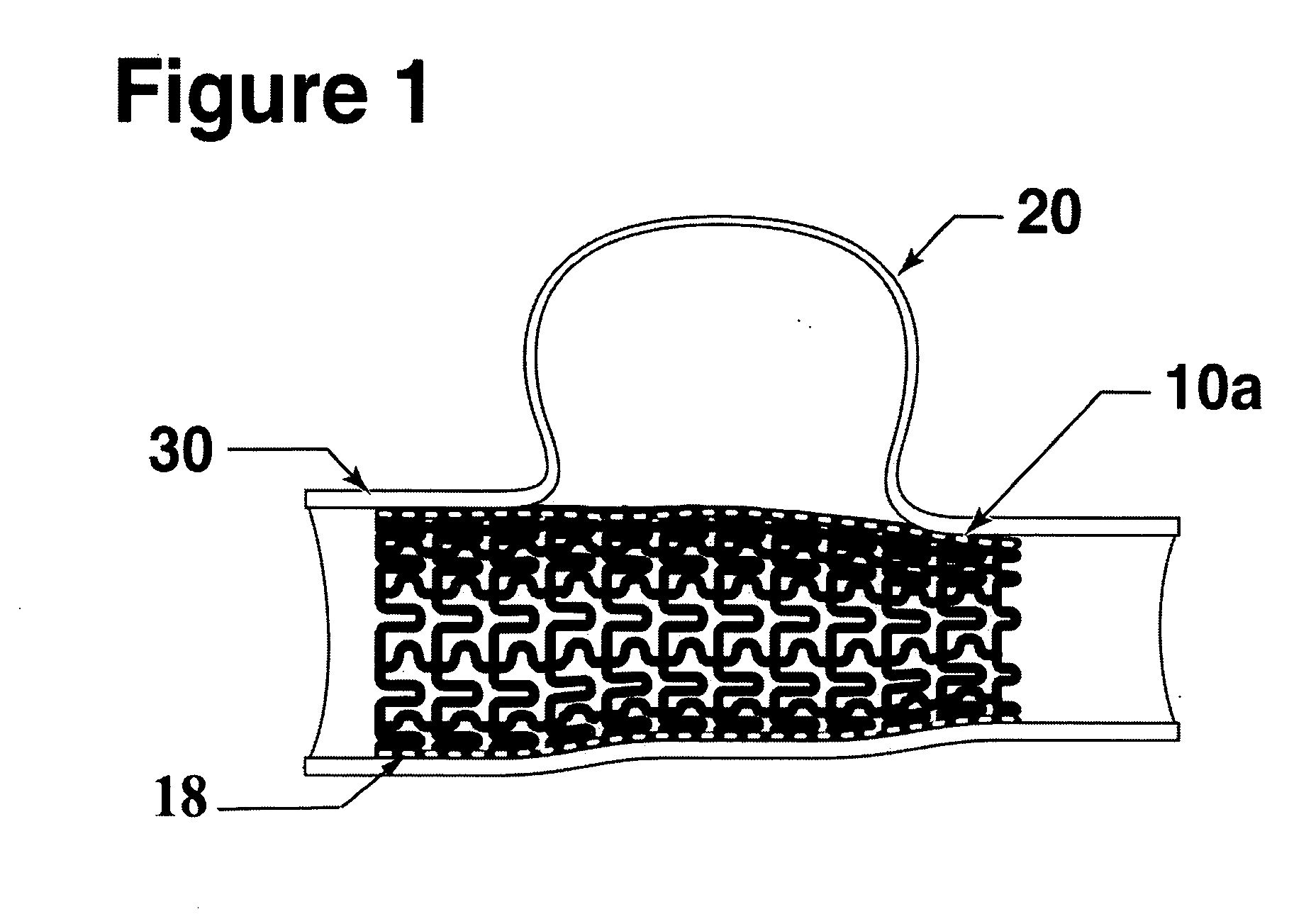 Micro-pleated stent assembly
