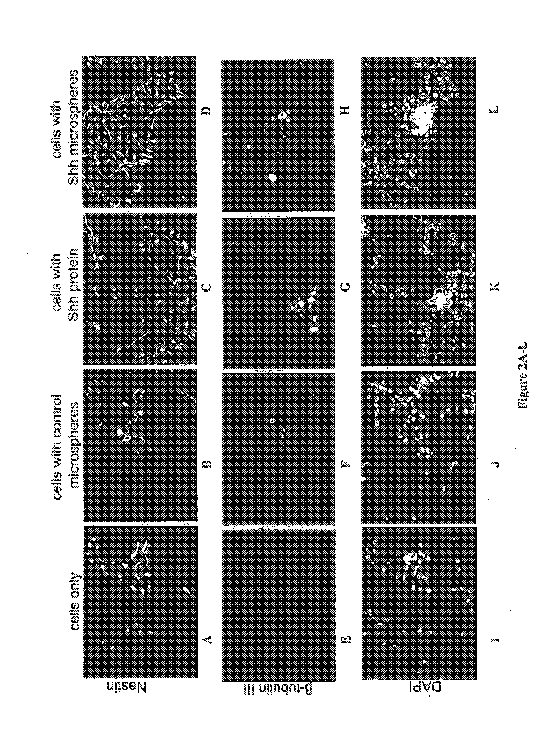 Methods and Compositions for Delivery of Exogenous Factors to Nervous System Sites