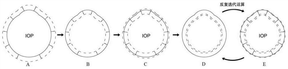 A simulation method of corneal postoperative situation