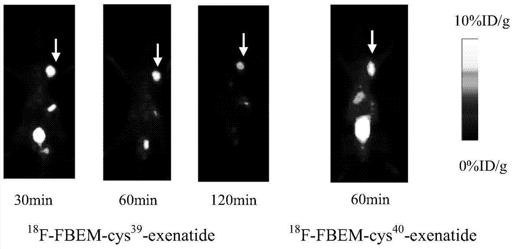 an exenatide  <sup>18</sup> f markers and preparation methods and applications