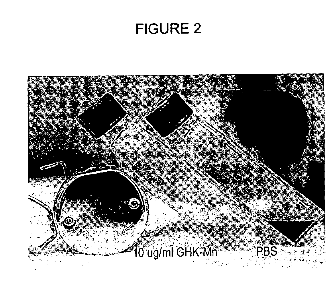 Methods and compositions for preventing and treating hyperpigmentation of skin