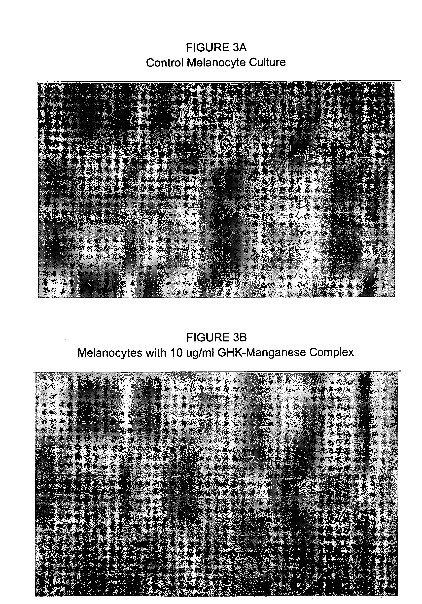Methods and compositions for preventing and treating hyperpigmentation of skin