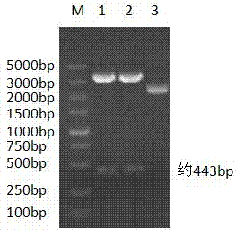 A gAd gene of porcine globular adiponectin and protein encoded by gAd gene and application