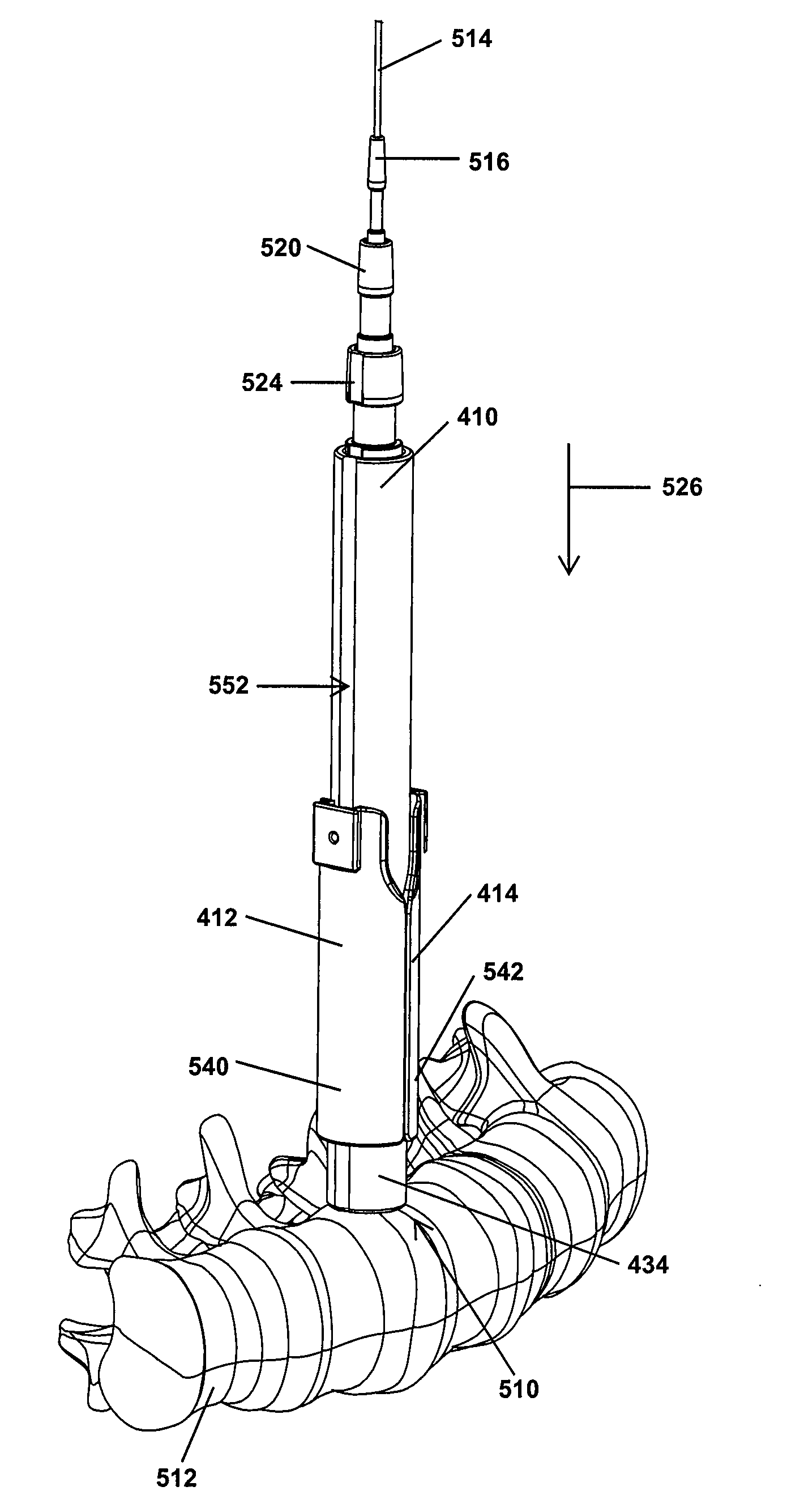 Apparatus and method for enlarging an incision