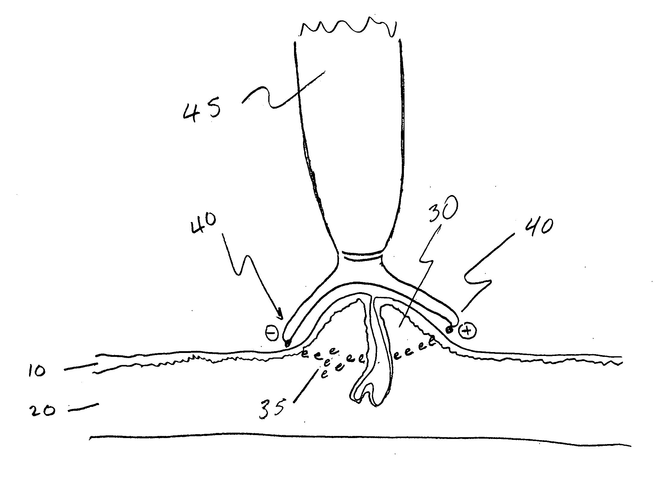 Acne and skin defect treatment via non-radiofrequency electrical current controlled power delivery device and methods