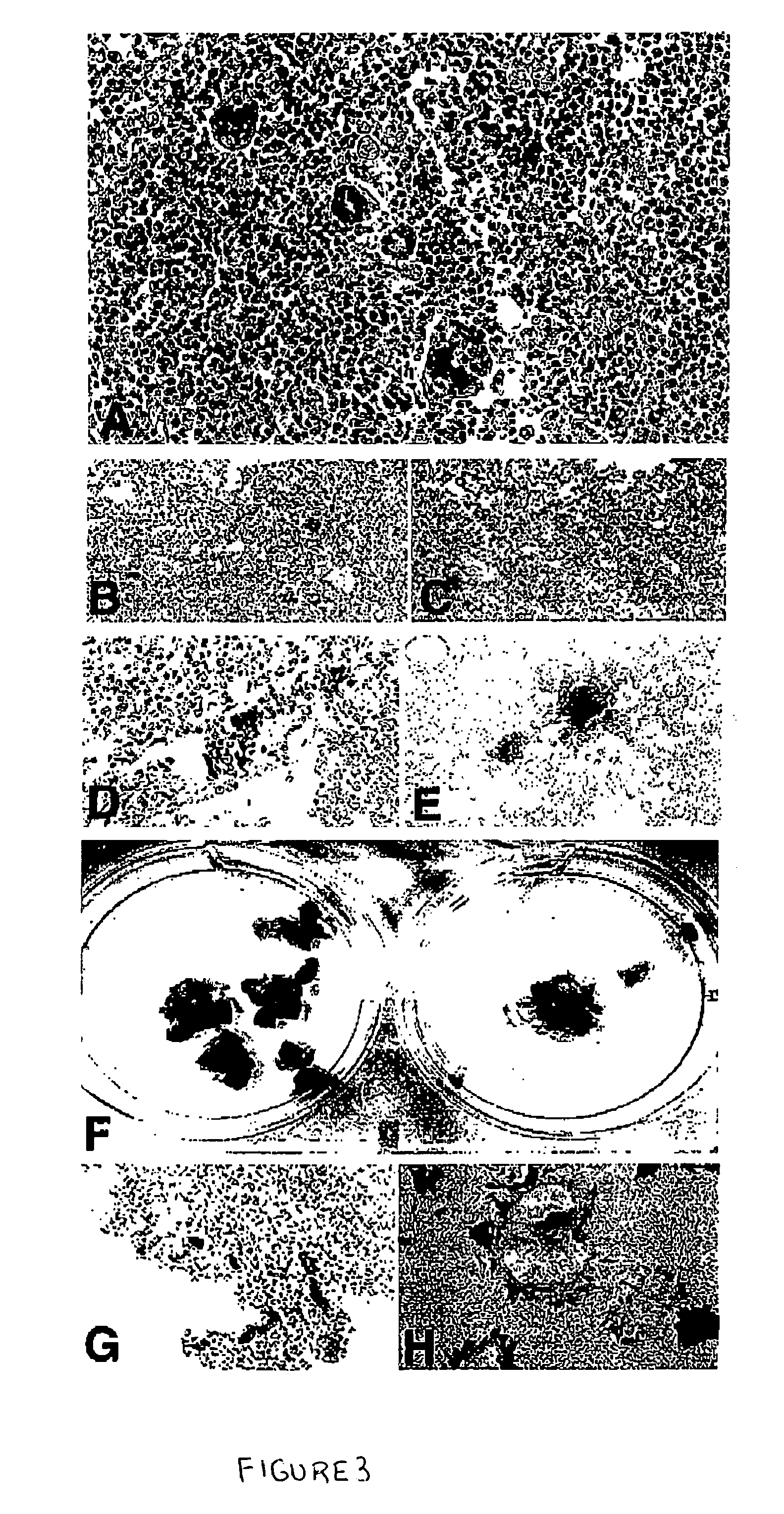 Method for limiting the growth of cancer cells using an attenuated measles virus
