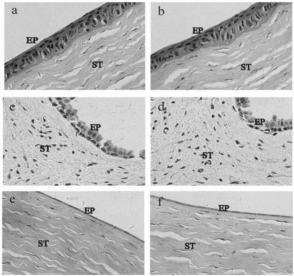 Cation-modified pilocarpine hydrochloride flexible nano-liposome eye-drops preparation and preparation method thereof