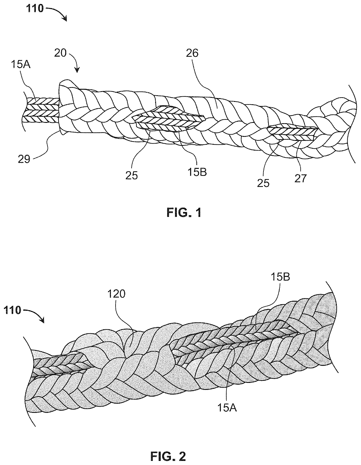 Bioactive soft tissue implant and methods of manufacture and use thereof