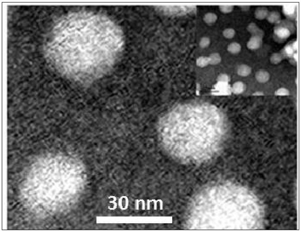 Preparation method of ultra-small bionic nanoparticles based on erythrocyte membrane