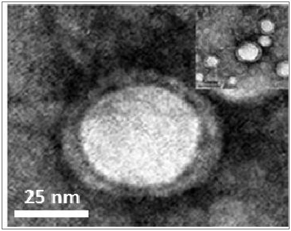Preparation method of ultra-small bionic nanoparticles based on erythrocyte membrane