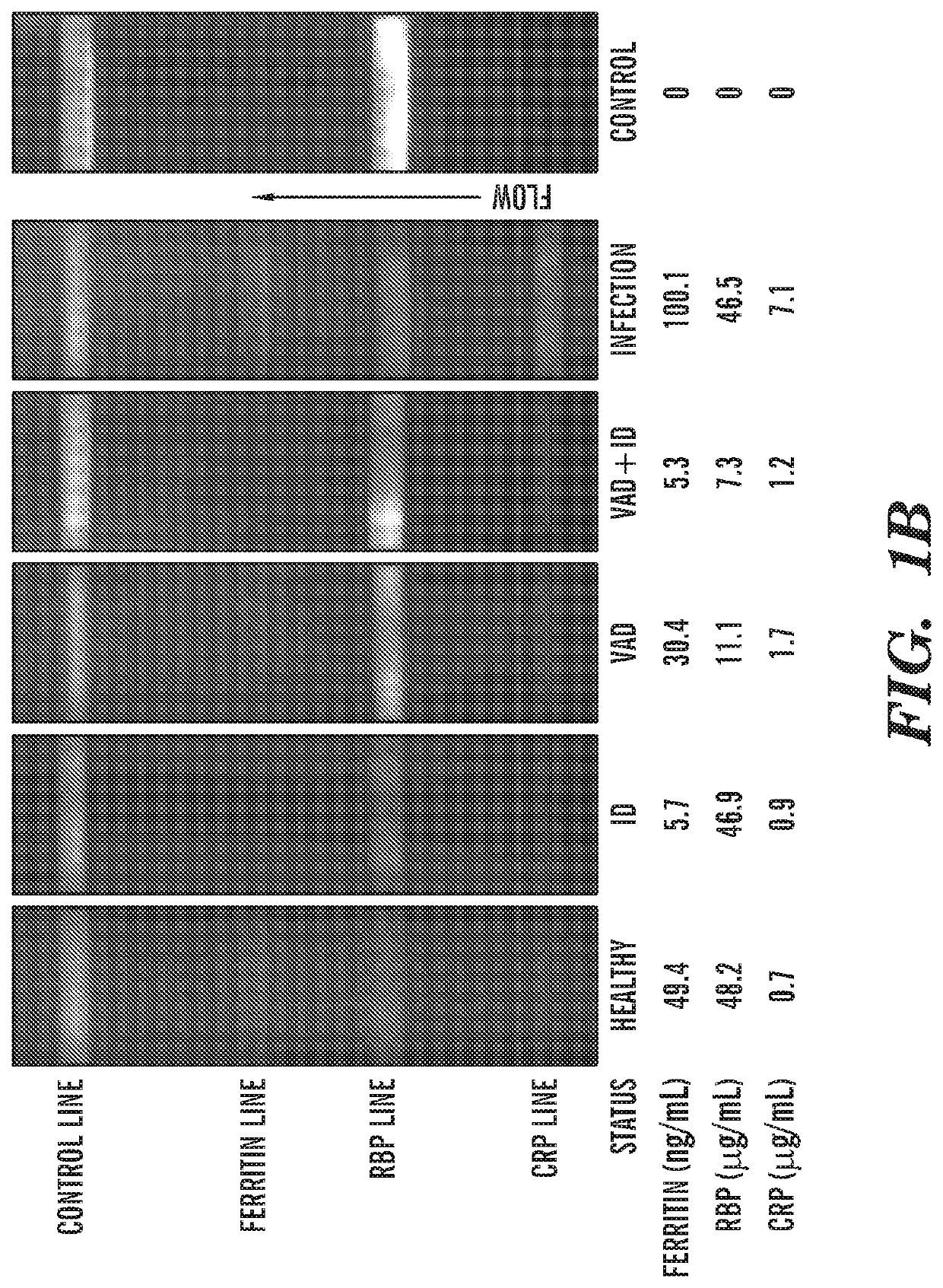 A multiplexed diagnostic assay for iron and vitamin a deficiency and methods of use thereof