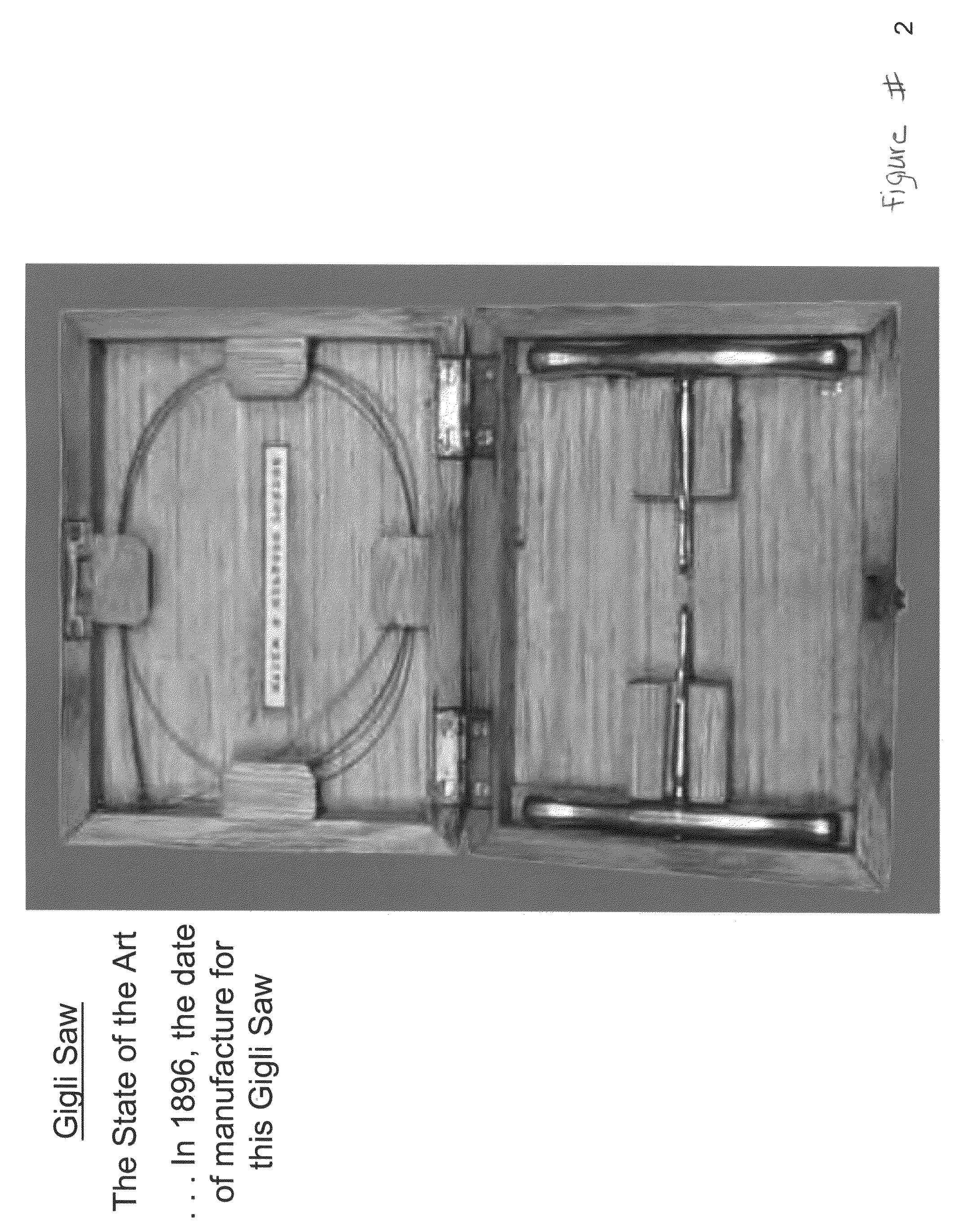 Method and apparatus for wireplasty bone resection