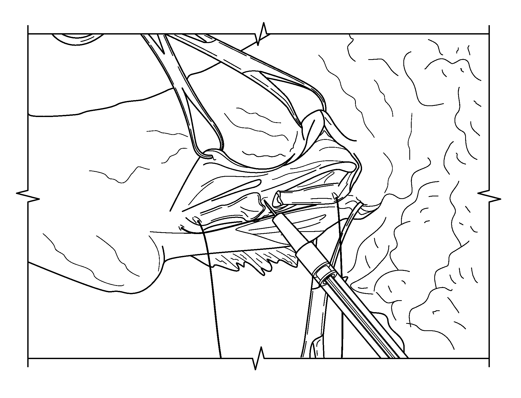 Platelet-derived growth factor compositions and methods for the treatment of tendon and ligament injuries