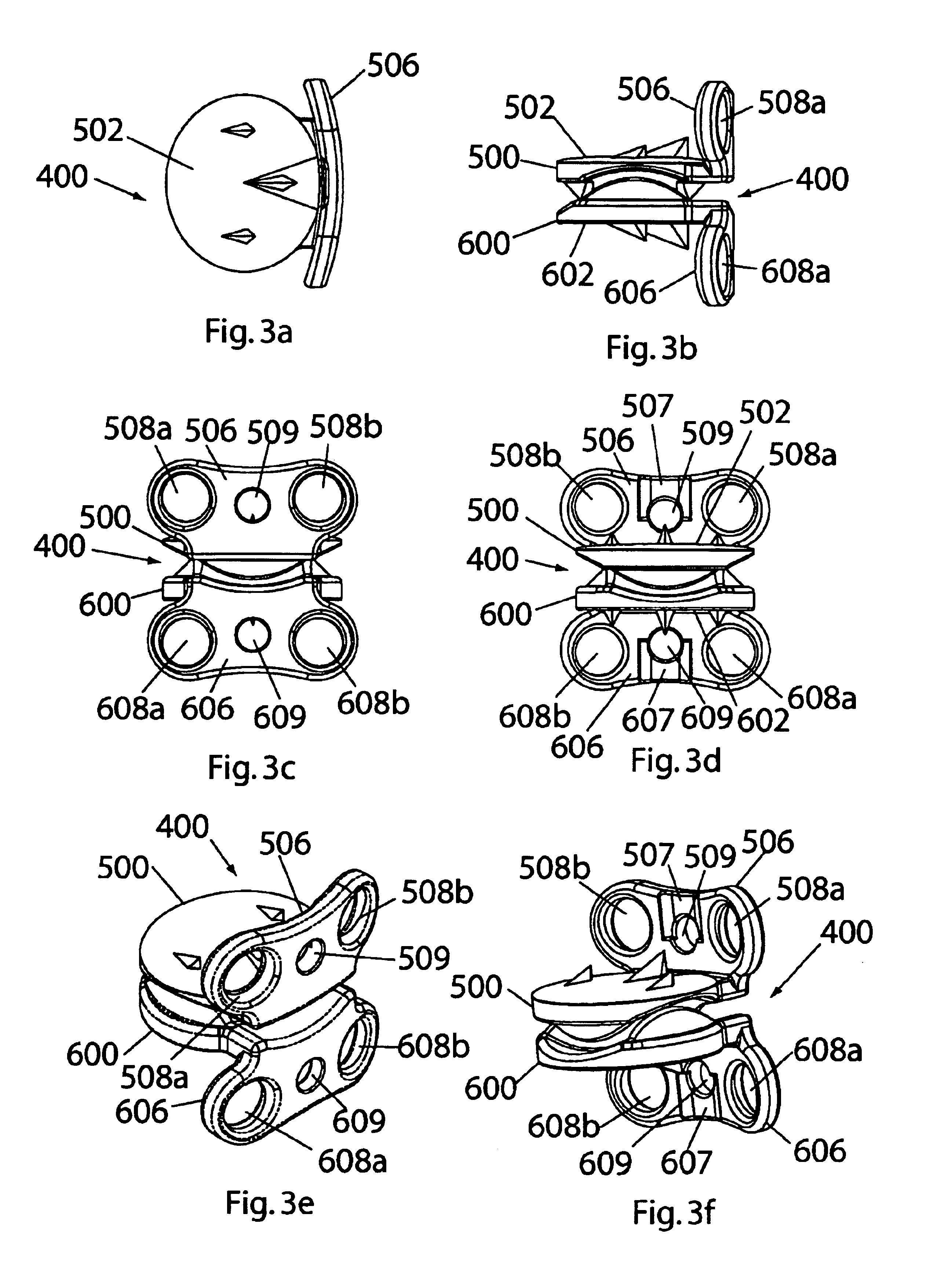 Instrumentation and methods for use in implanting a cervical disc replacement device