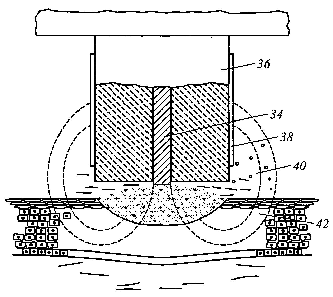 Electrosurgical method and system for treating foot ulcer