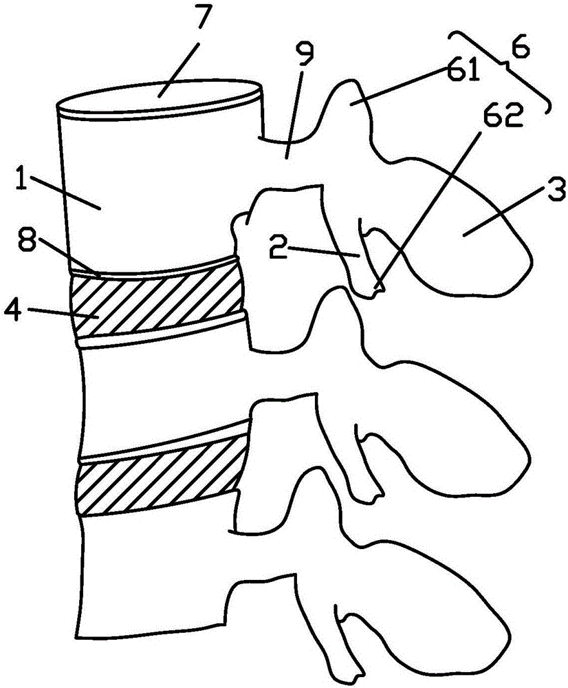 Vertebral plate lower portion strutting movement apparatus