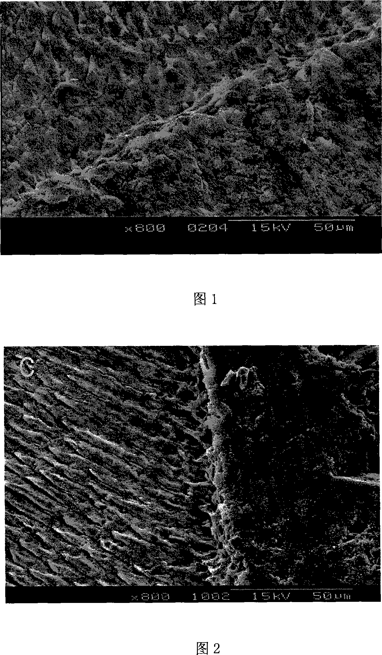 Method for preparing visible light solidified orthodontic binder containing 3-META functional monomer