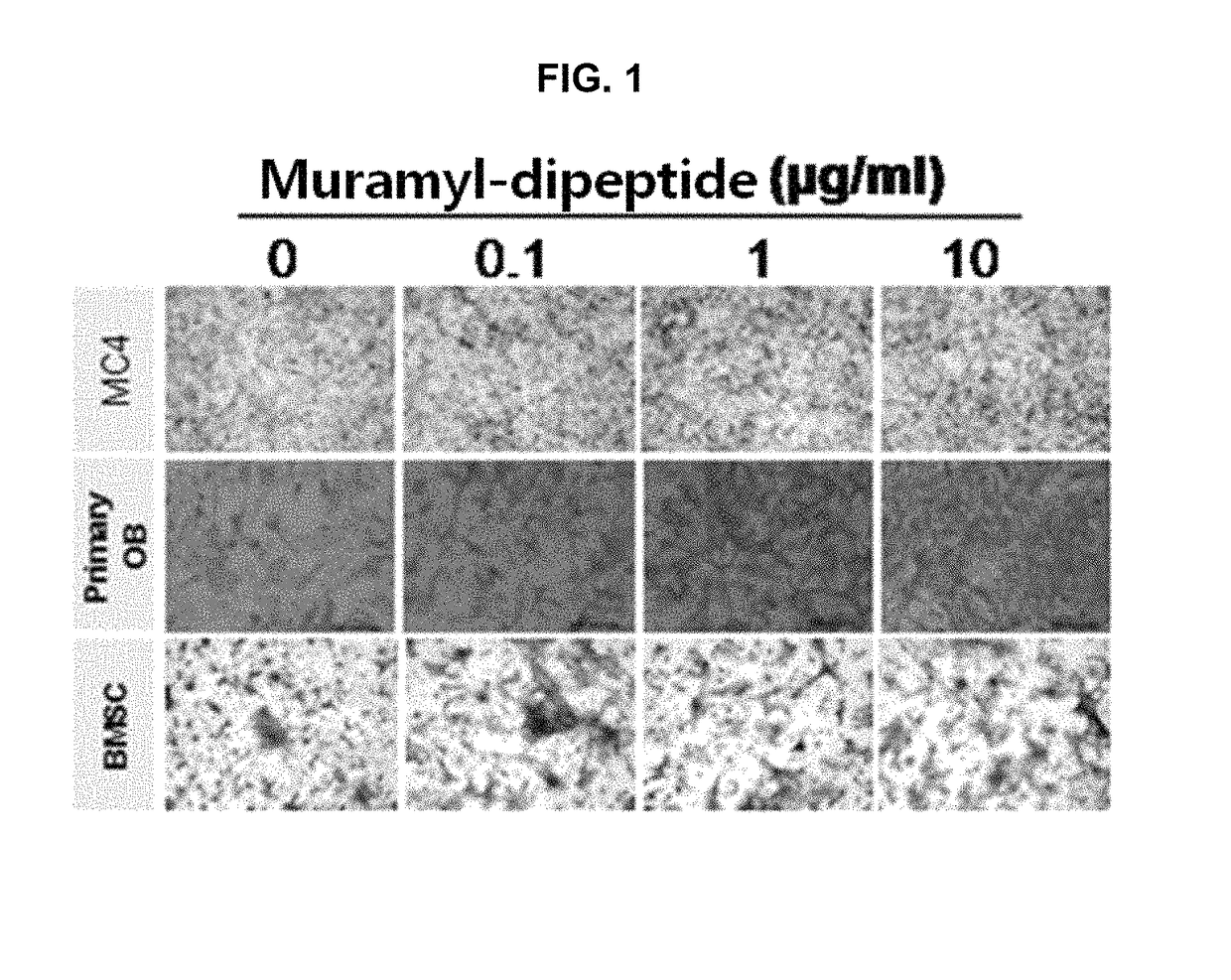 Bone loss preventing and bone regeneration or bone formation promoting pharmaceutical composition comprising muramyl dipeptide