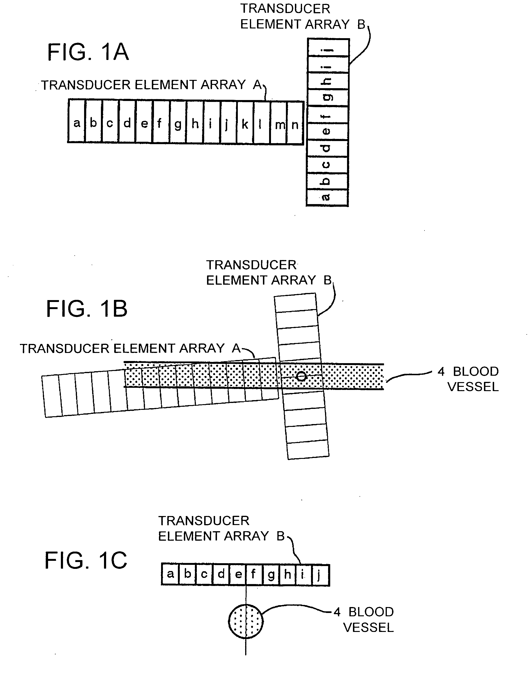 Ultrasonic diagnosing device