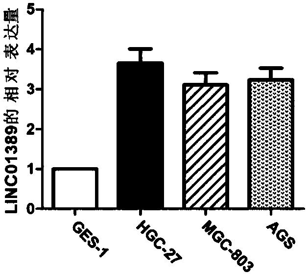 Application of LINC01389 in diagnosis and treatment of stomach cancer