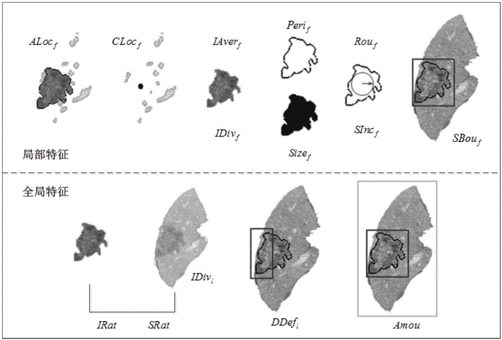 Three-way-decision-based liver tumor CT image classification method
