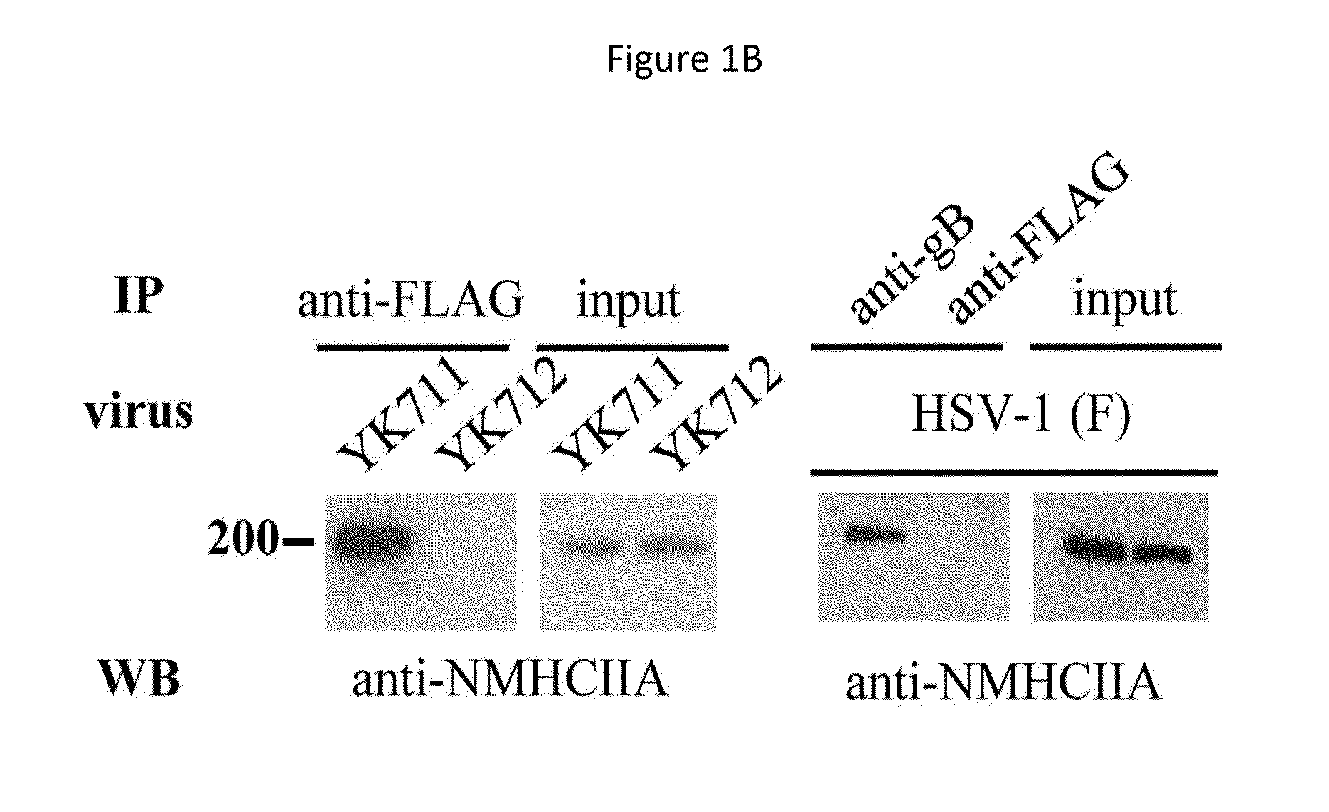 Pharmaceutical Composition for Treatment and Prevention of Herpes Virus Infections