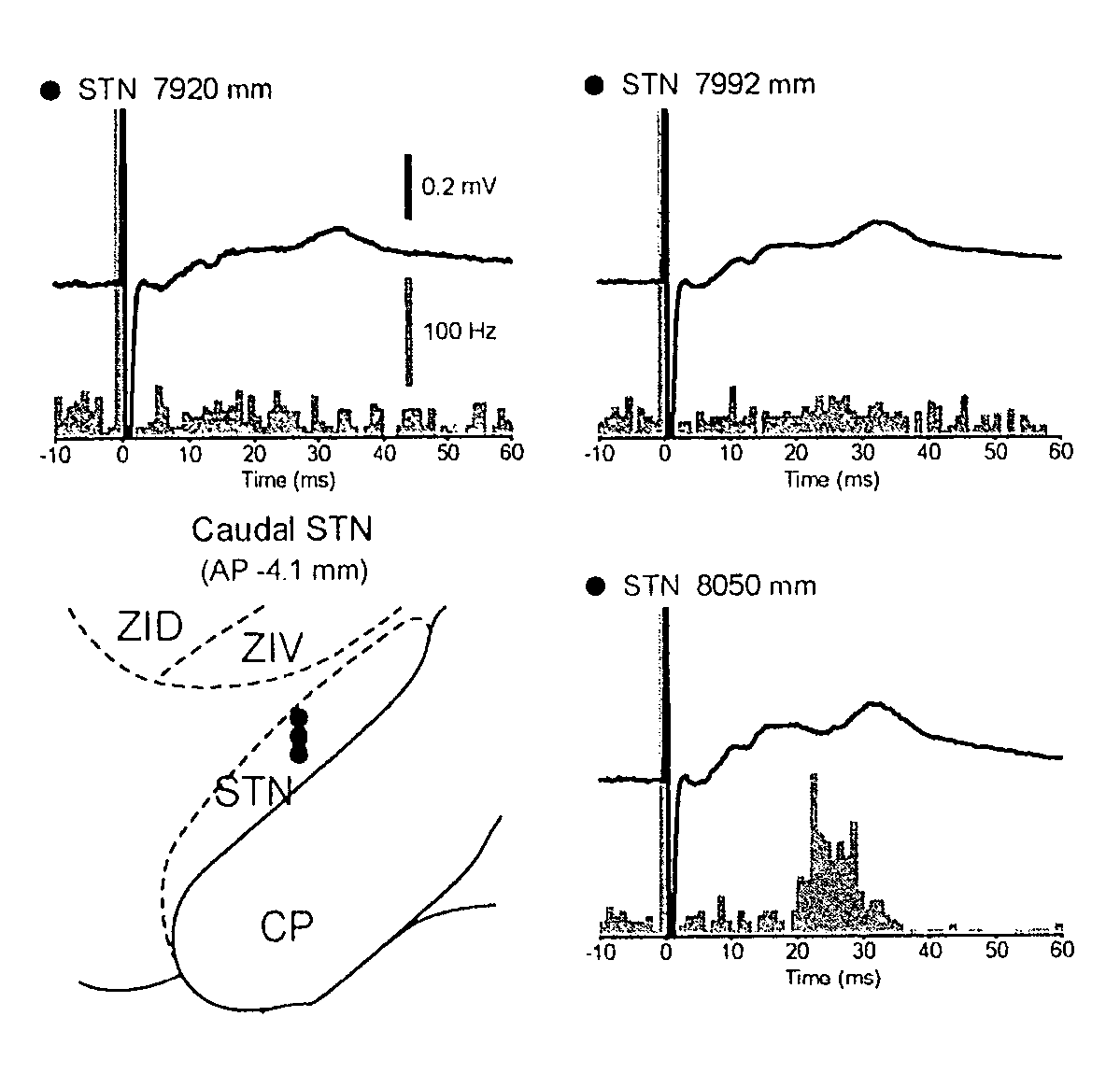 Methods of neural centre location and electrode placement in the central nervous system