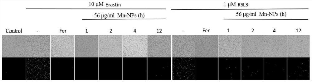 Manganese-based nano-enzyme as ferroptosis inhibitor and application of manganese-based nano-enzyme in liver injury