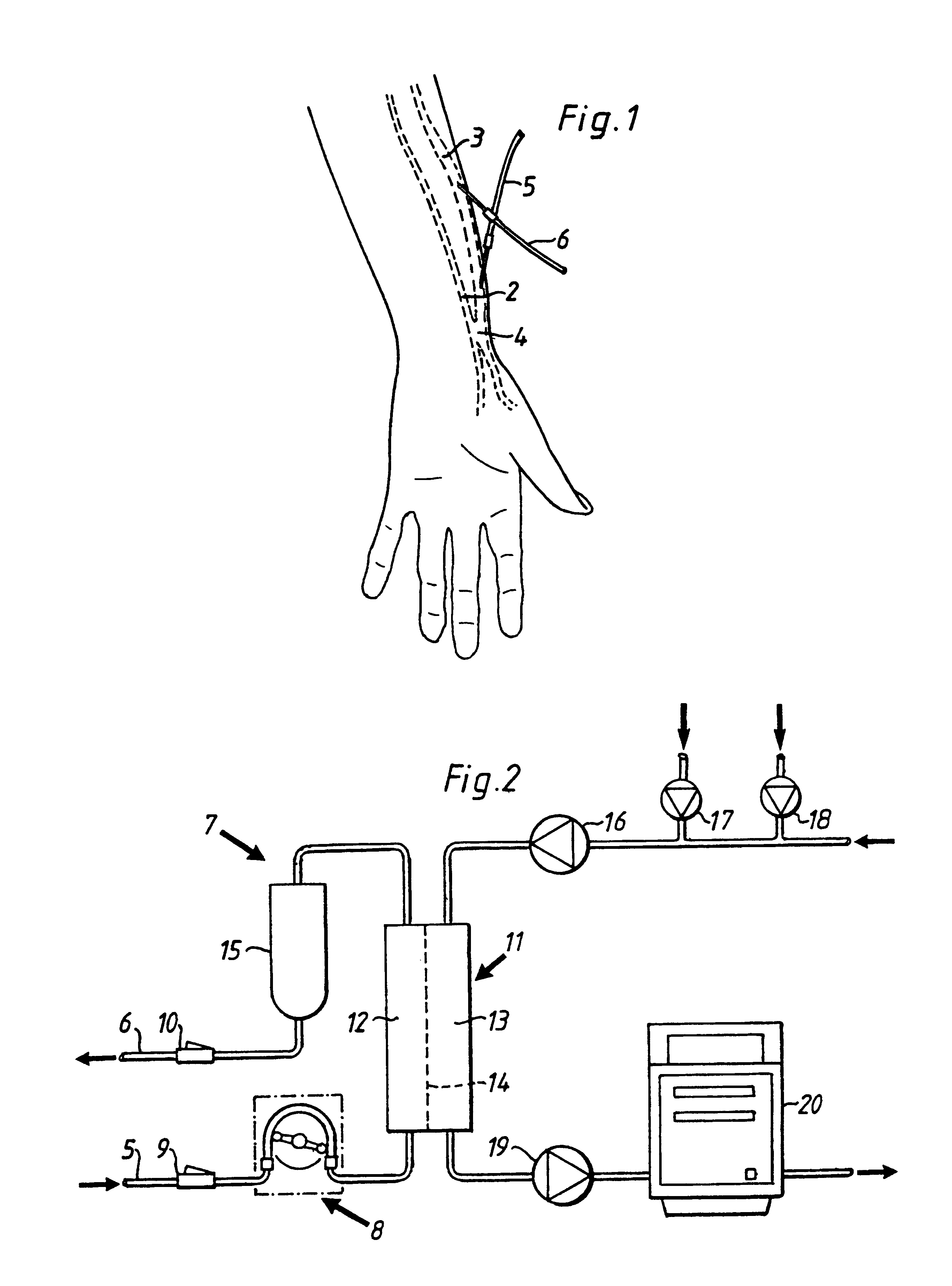 Method and device for measuring access flow