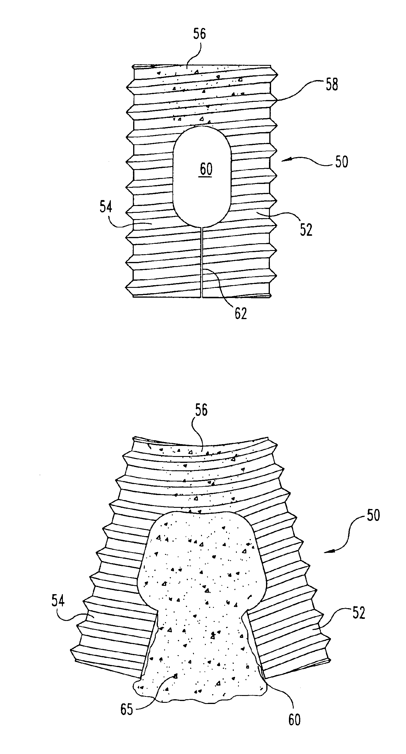 Flexible implant using partially demineralized bone