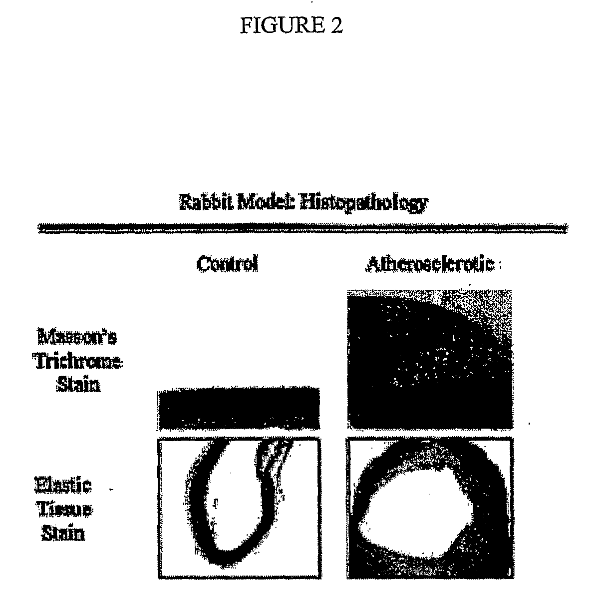 Methods of Enhanced Detection and Therapy of Inflamed Tissues Using Immune Modulation