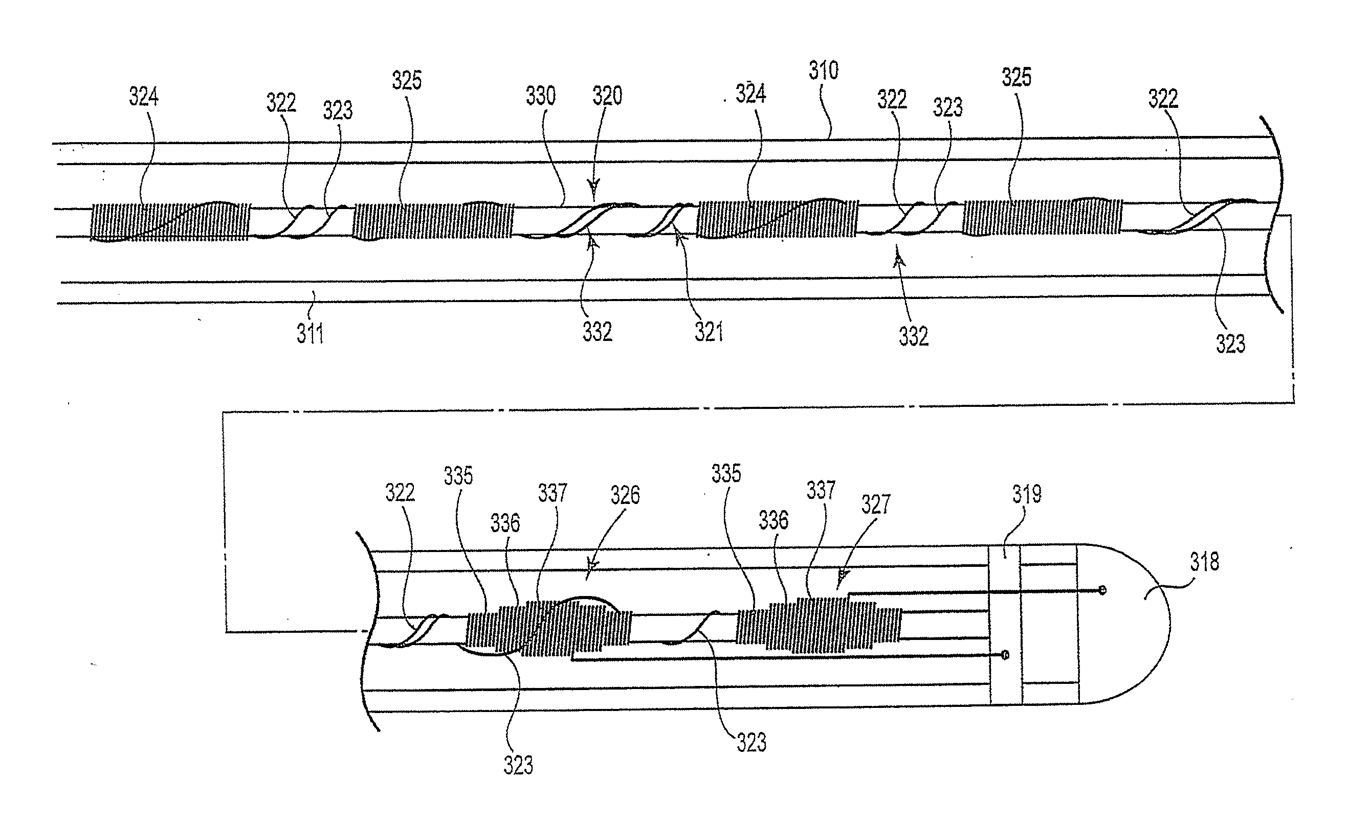 MRI compatible co-radially wound lead assembly