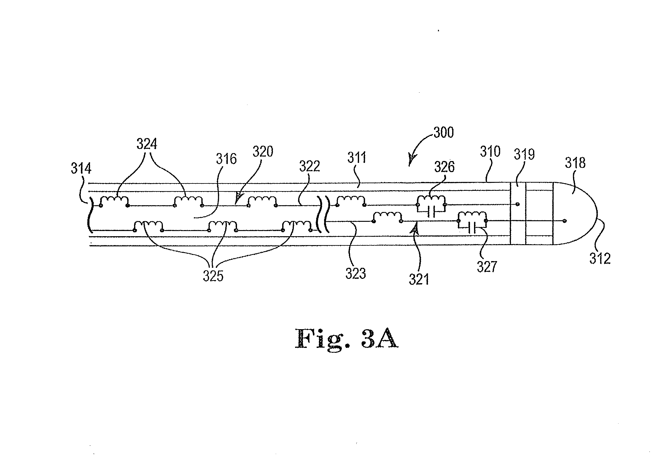 MRI compatible co-radially wound lead assembly
