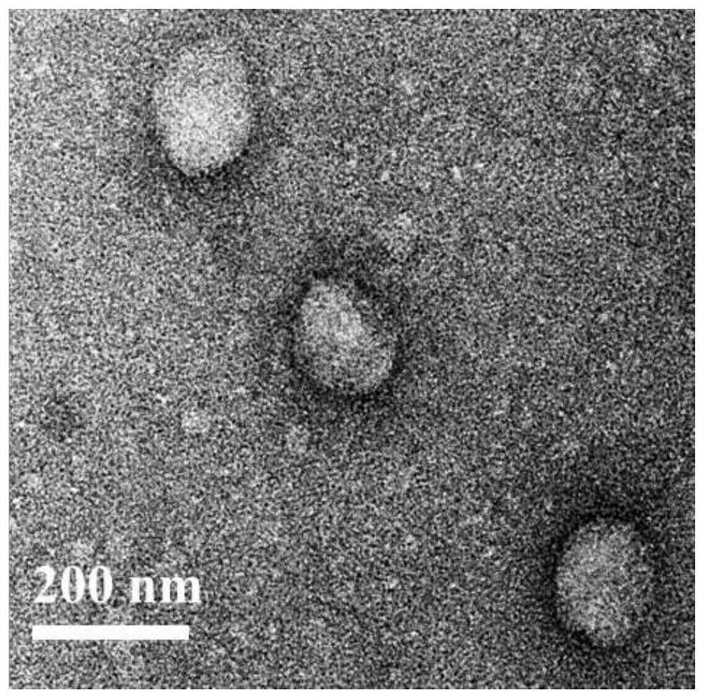 Preparation method and application of oxygen-carrying hybrid protein loaded metal complex nano-system