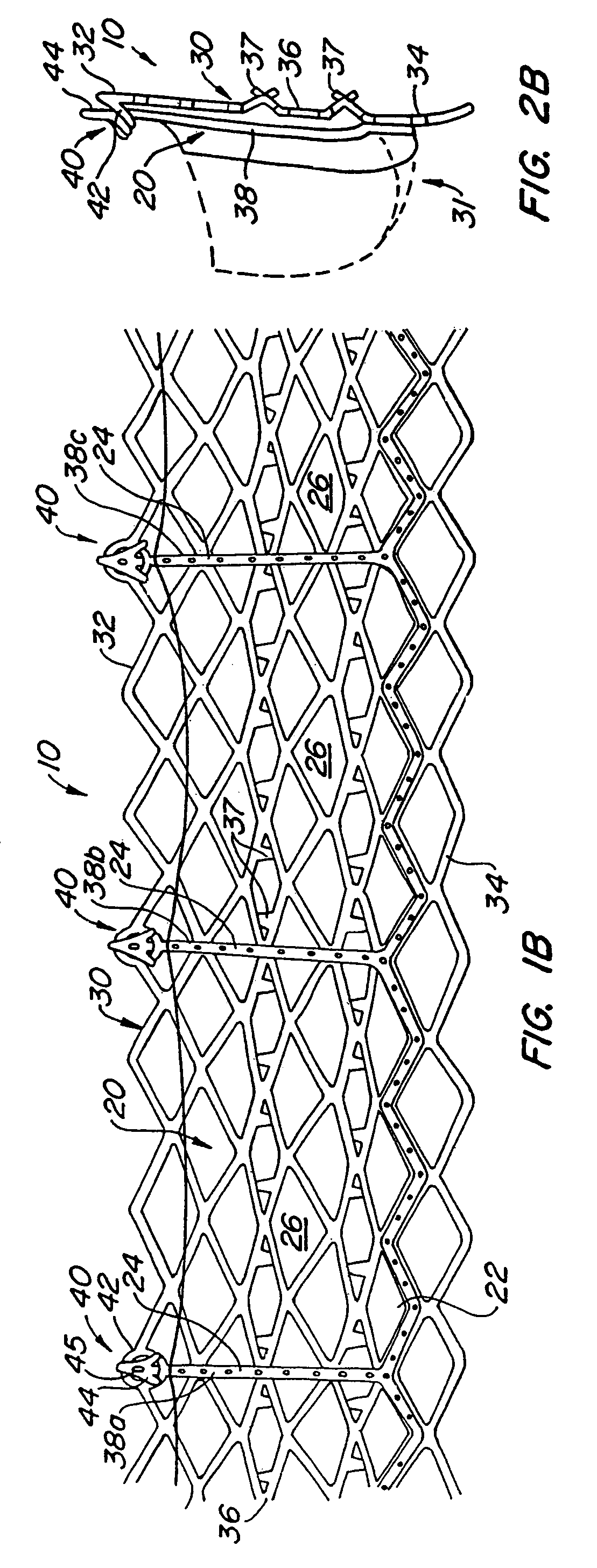 Low profile heart valve and delivery system
