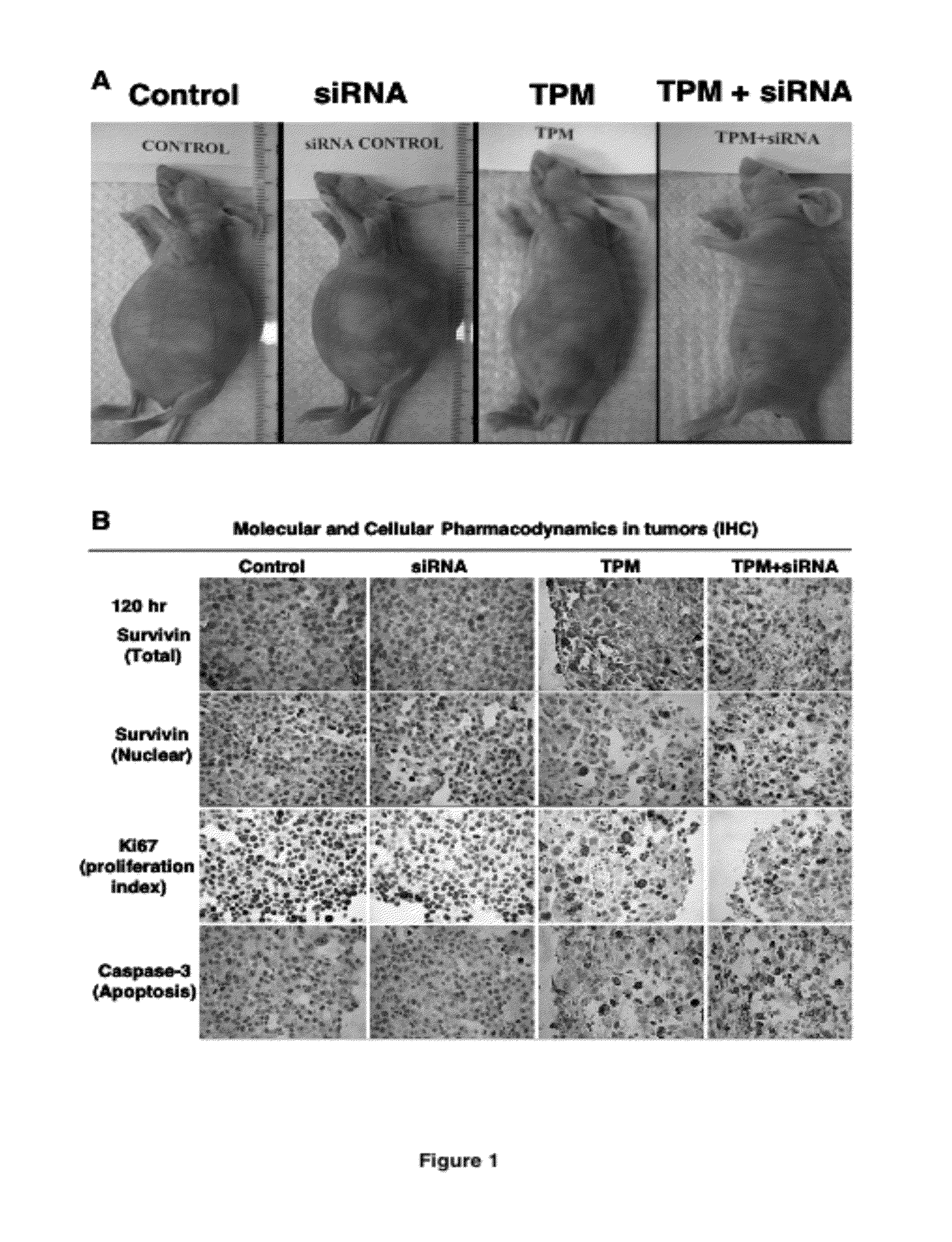 Methods and compositions for improved deliver, expression or activity of RNA interference agents