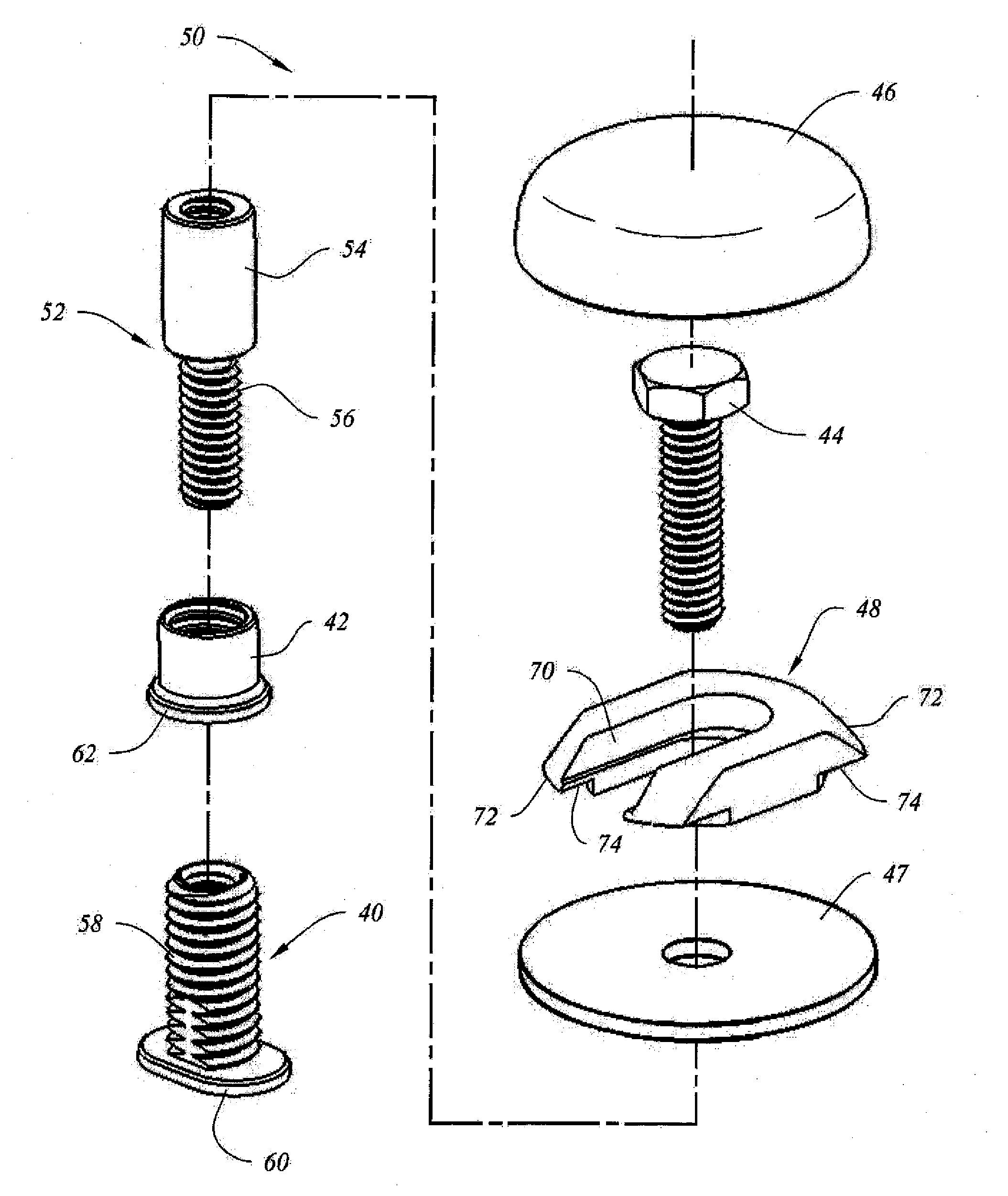 Toilet Fastener Assembly and Method of Use
