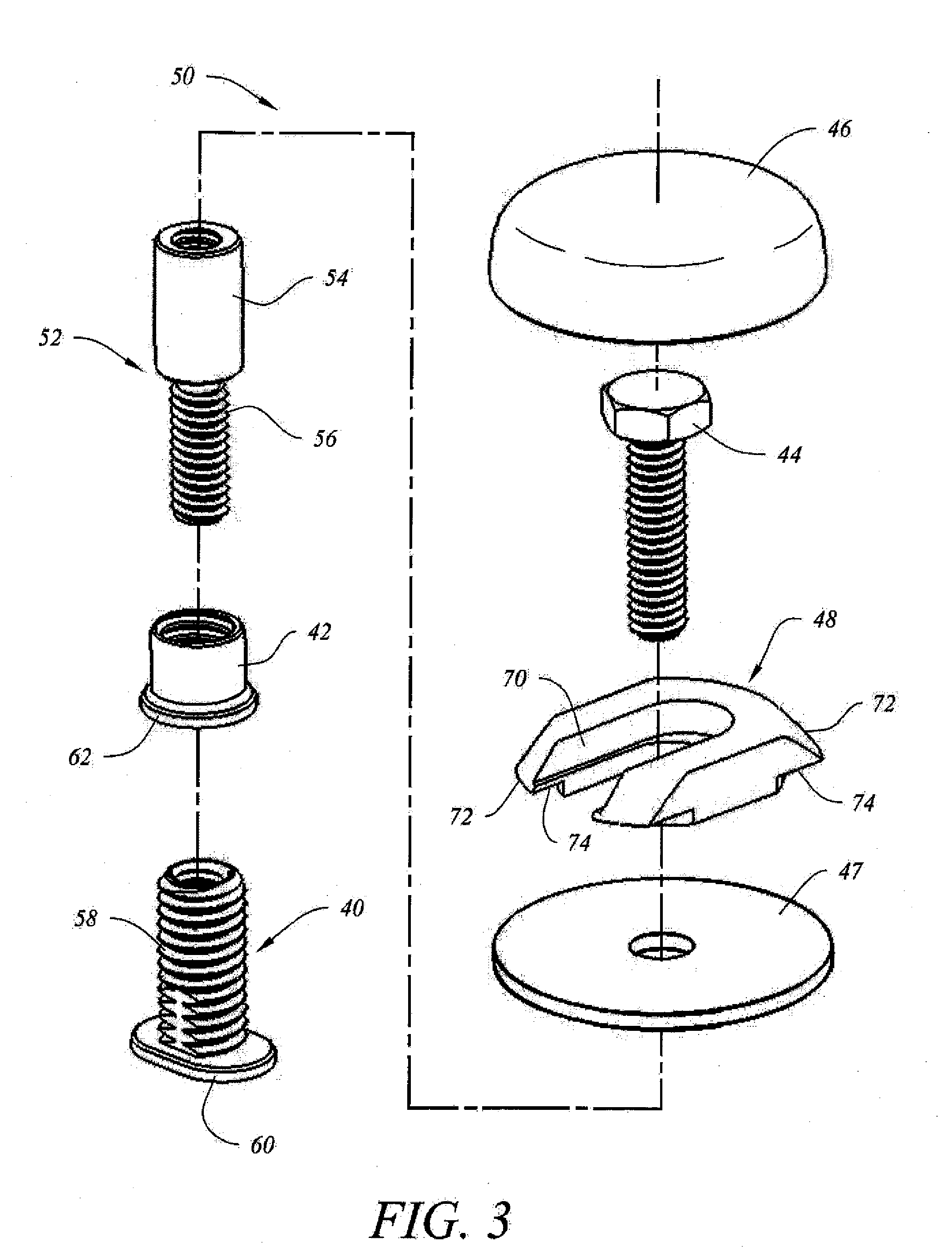 Toilet Fastener Assembly and Method of Use