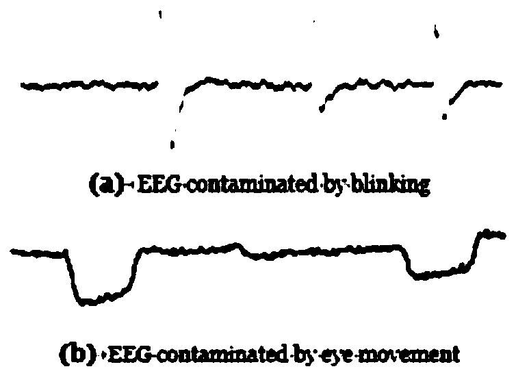 System and method for removing ocular artifact from electroencephalogram signal