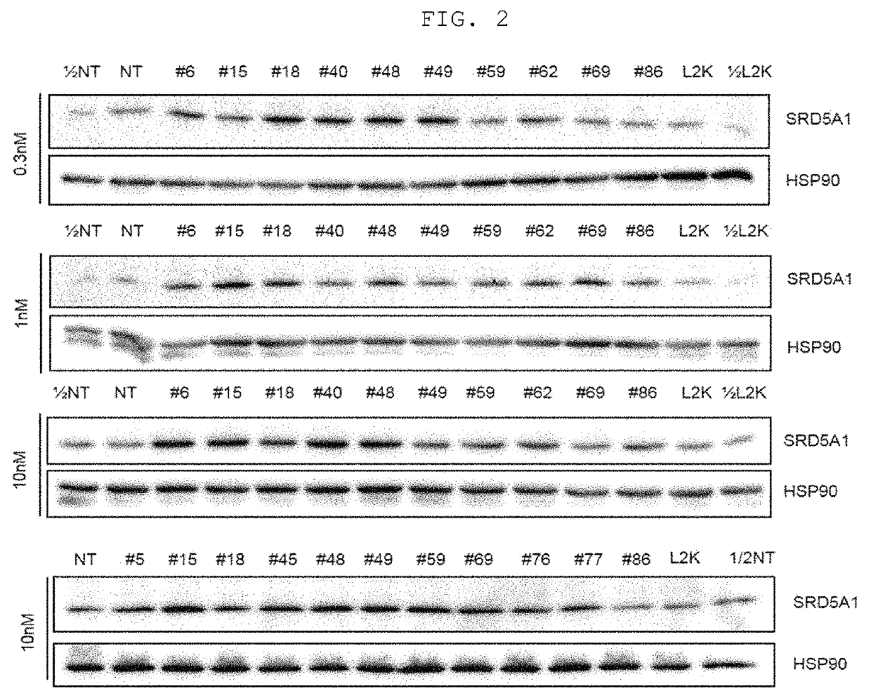 Asymmetric siRNA for inhibiting expression of male pattern hair loss target gene