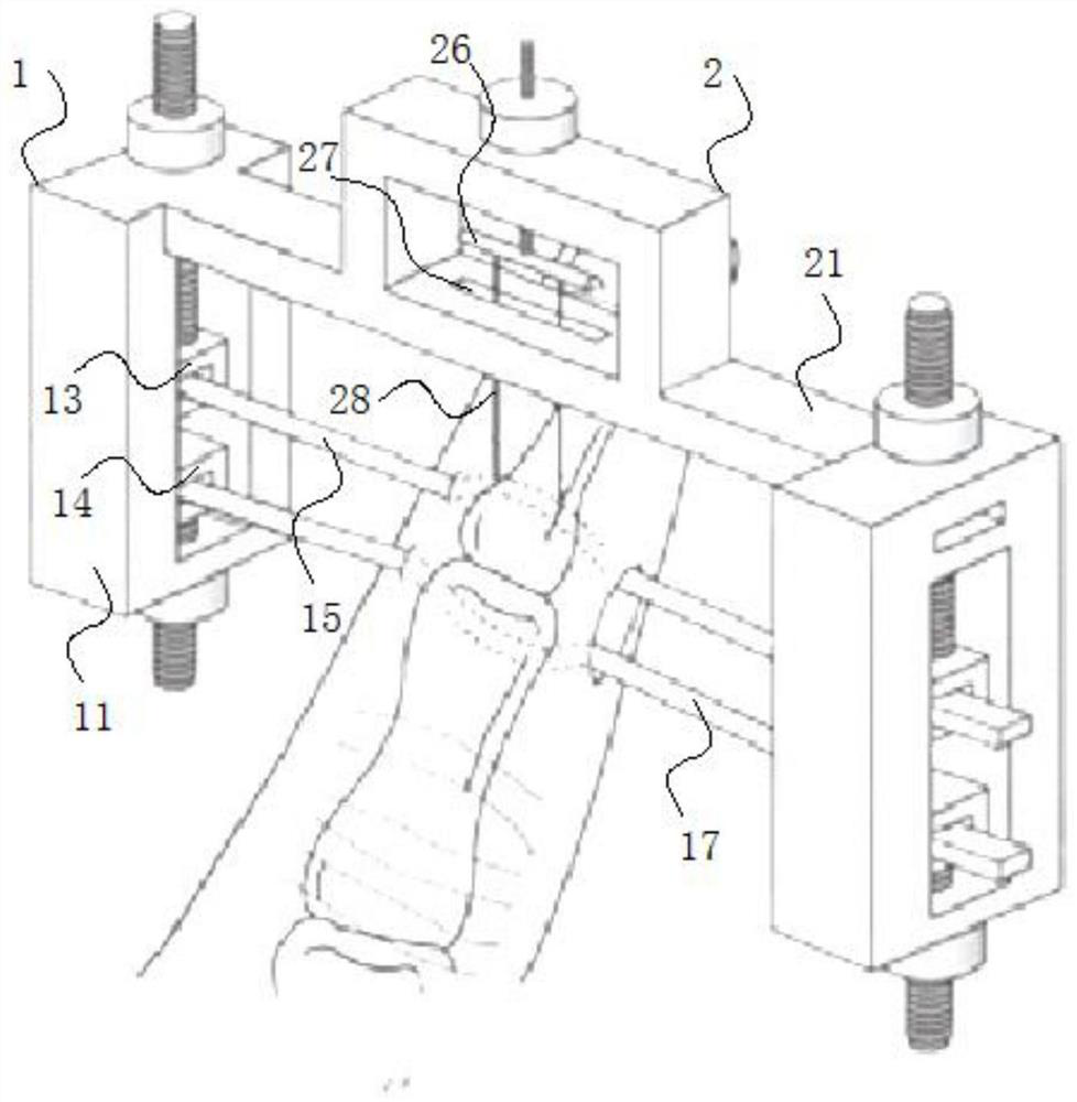 Minimally invasive phalanx avulsion fracture reduction internal fixation device