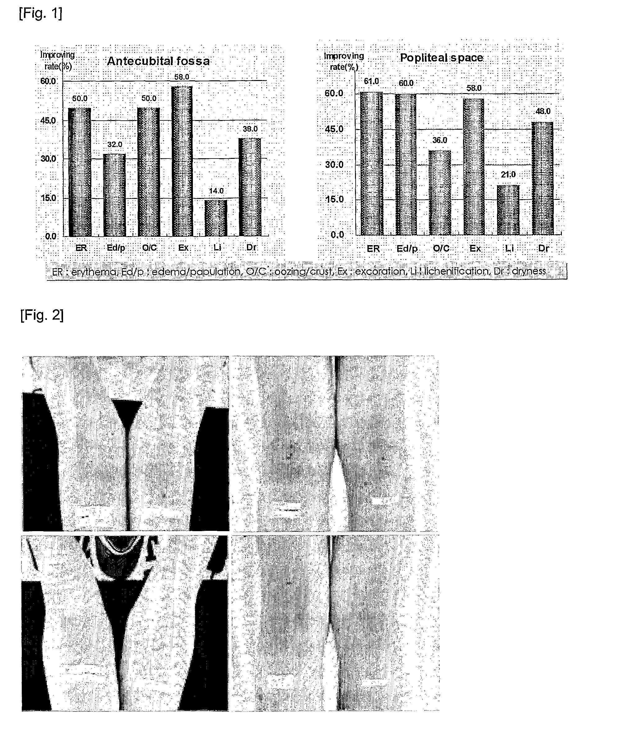 Composition for treating atopic dermatitis comprising extracts of bamboo and Scutellaria