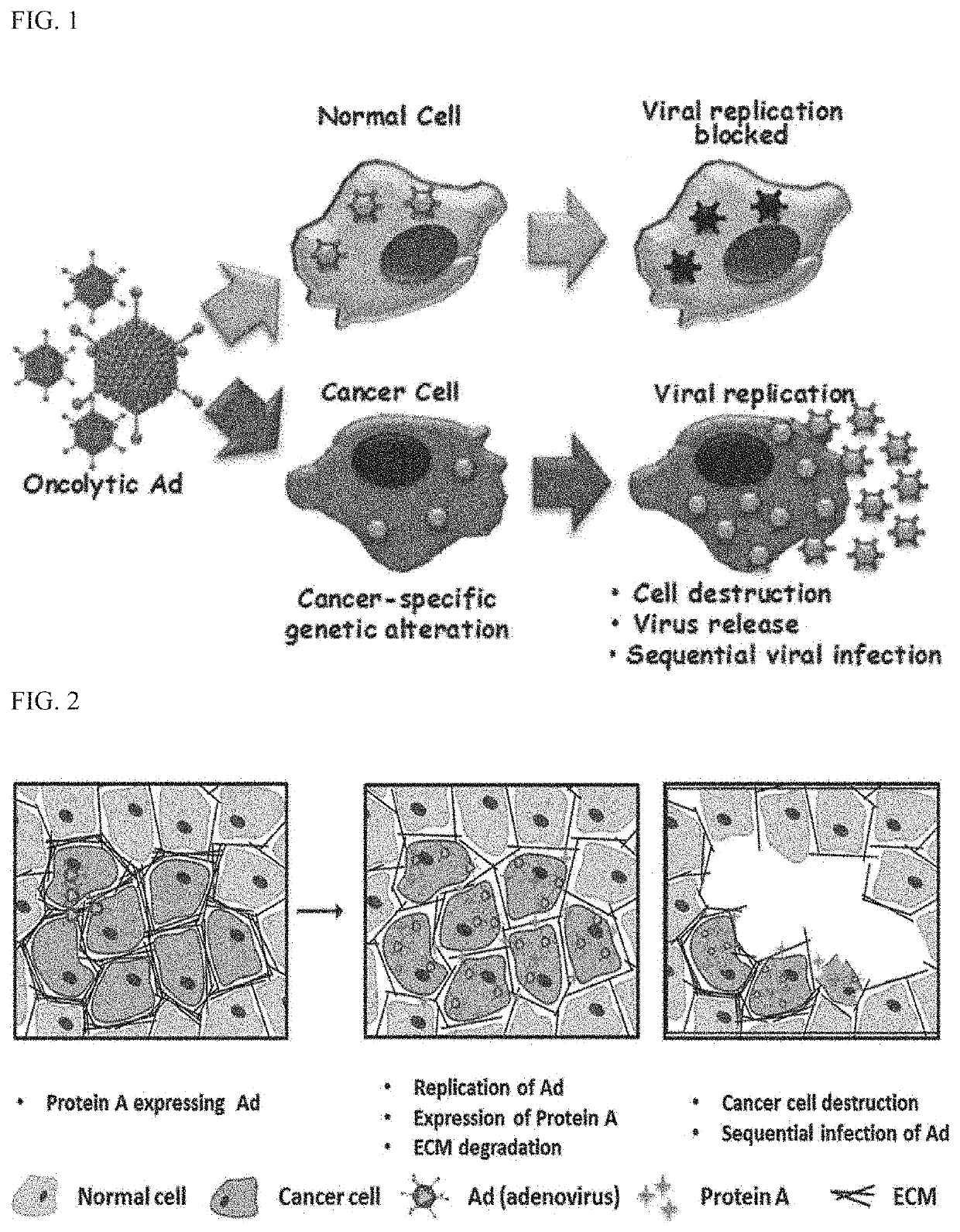 Anticancer composition comprising recombinant adenovirus expressing degradation factor for extracellular matrix